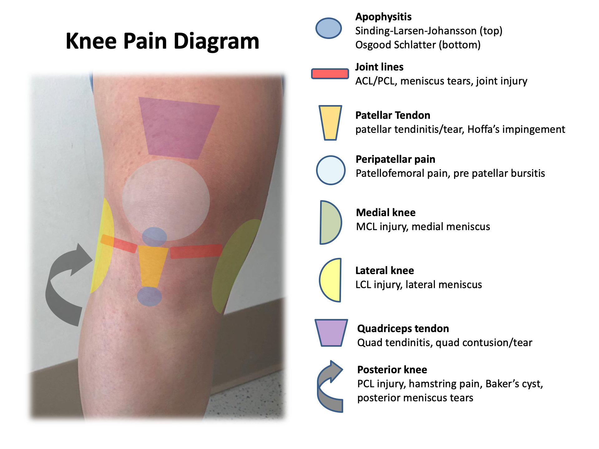 What is the best diagnostic tool for knee pain?
