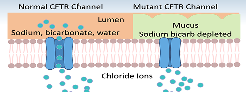 Diagram of normal CFTR channel and mutated CFTR channel