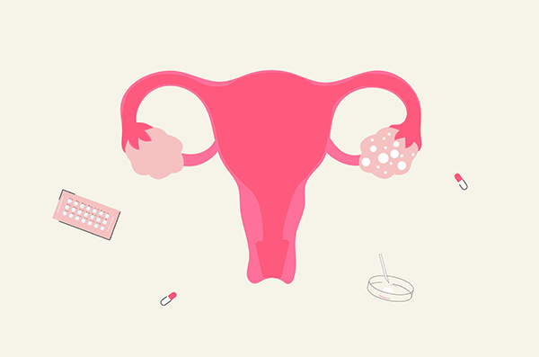 uterus, contraception pills, lab dish