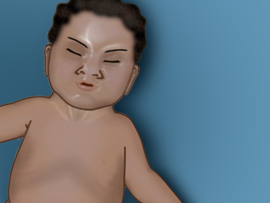 Illustration of baby in respiratory distress