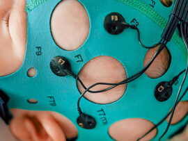 Neonatal Seizures and Neonatal-Onset Epilepsy (30 min.)