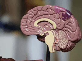 Functional (Psychogenic Non-Epileptic) Seizures (21 min.)